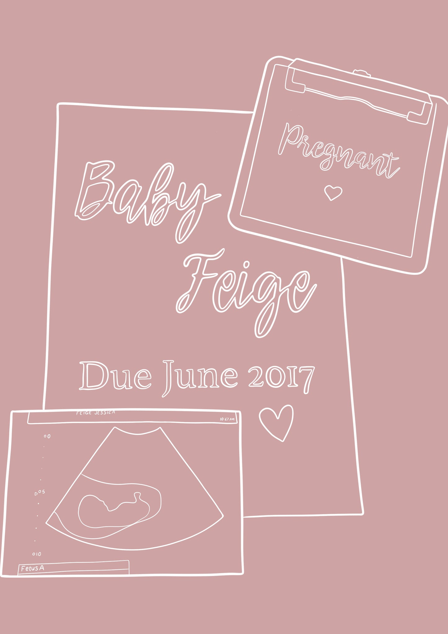 Custom Pregnancy Announcement - Dusty Rose