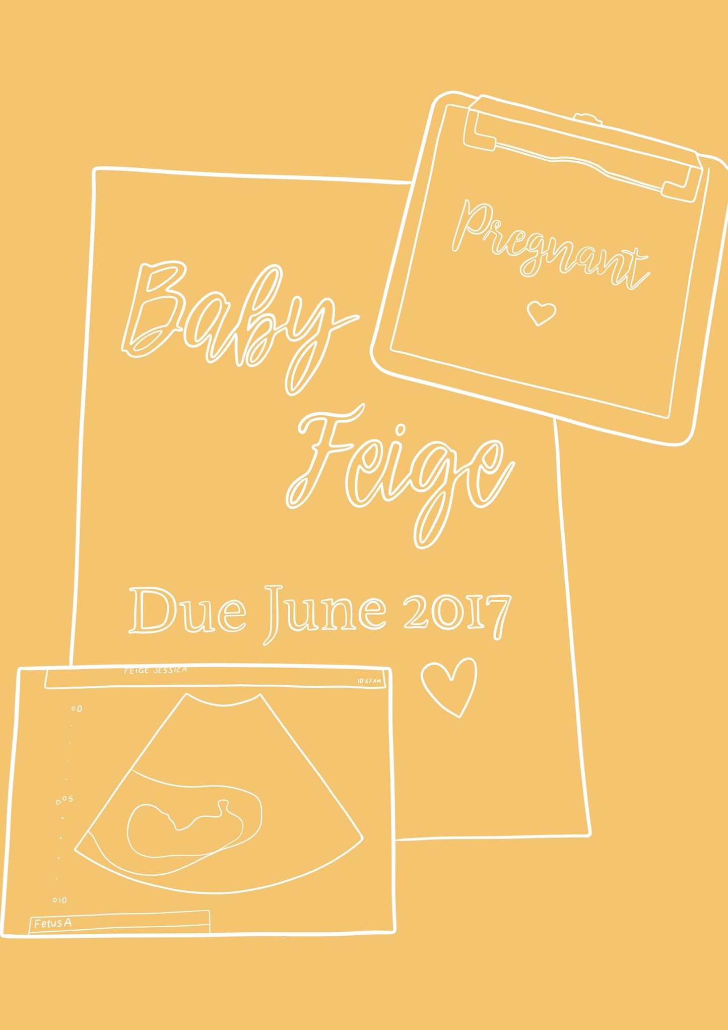 Custom Pregnancy Announcement - Yellow